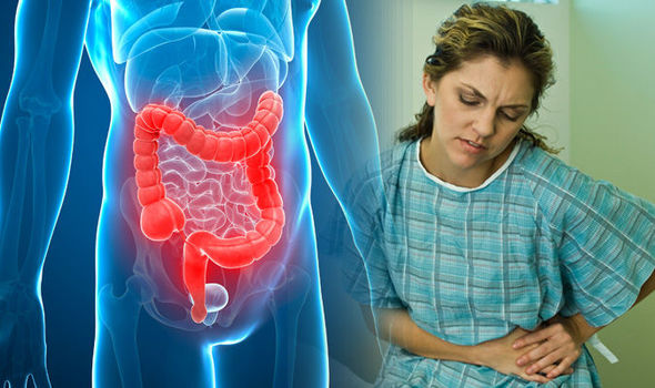 Ulcerative-colitis-symptoms-Signs-of-the-disease-800188
